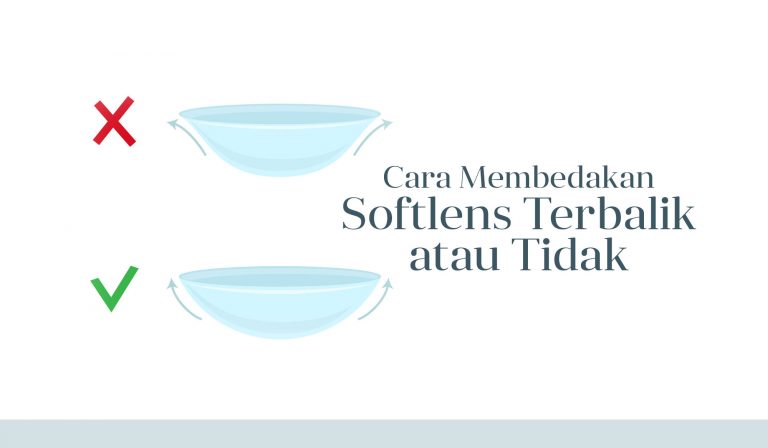 Cara Membedakan Softlens Terbalik atau Tidak